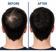 Load image into Gallery viewer, PHYTO PARIS phytocyane_ men anti-Hair loss shampoo 250ml شامبو فيتو للرجال لتحقيق فروة الشعر من القشرة والحفاظ على شعر صحي وكثيف
