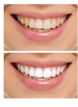 Load image into Gallery viewer, artnaturals whitening pulling oil kit pulling oil + toothbrush +tongue scraper 236ml
