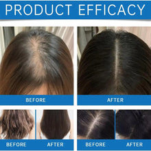 Load image into Gallery viewer, seapuri scalpy hair serum 20ml سيرم تكثيف الشعر وتغذية البصيلات
