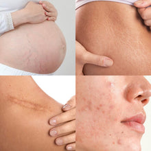 Load image into Gallery viewer, Bio-Oil Skincare Oil 25ml
