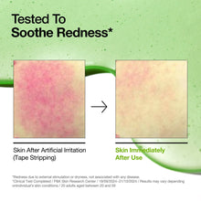 Load image into Gallery viewer, Azelaic Acid 10 Hyaluron Redness Soothing Serum
