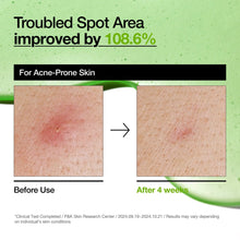 Load image into Gallery viewer, Azelaic Acid 10 Hyaluron Redness Soothing Serum
